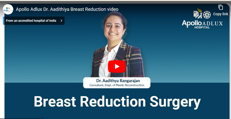 Quick facts about breast reduction!